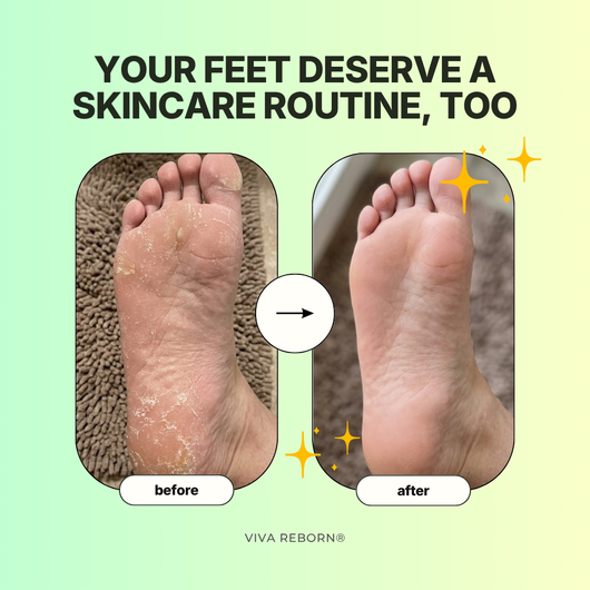 Korean Instant Foot Peeling Spray™